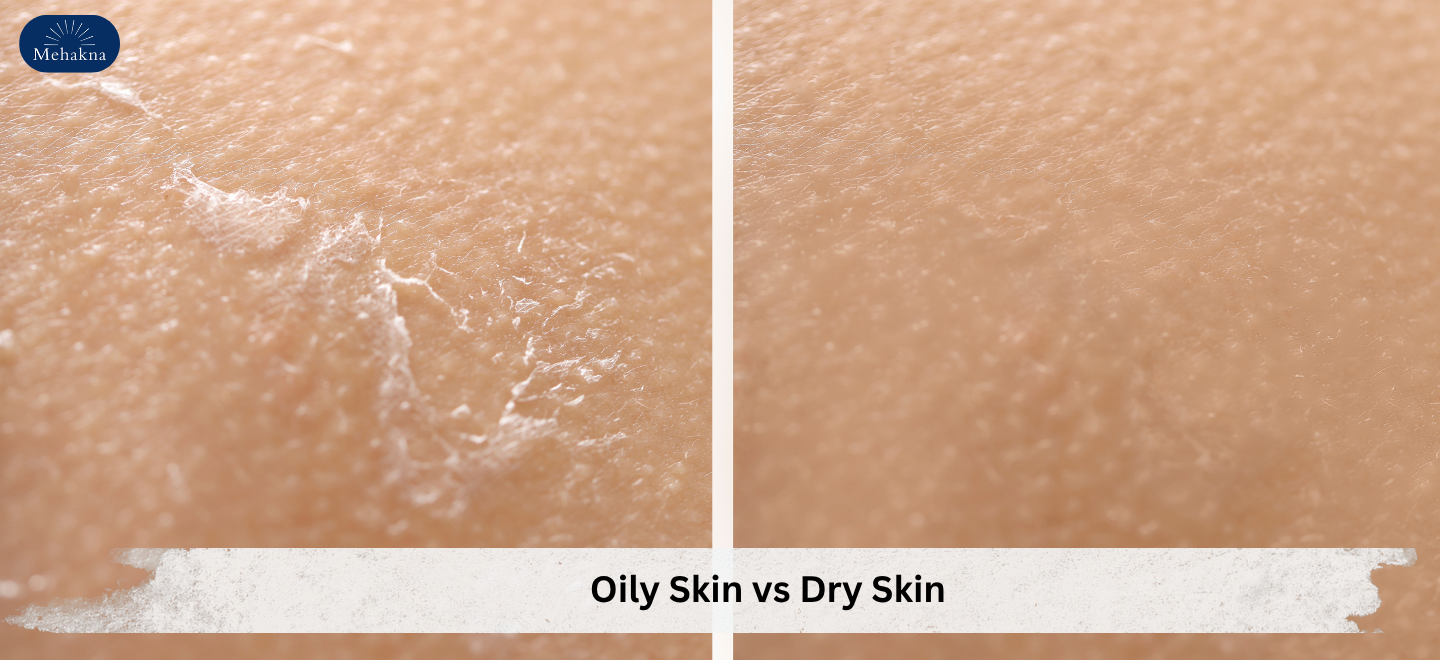 Oily Skin vs Dry Skin